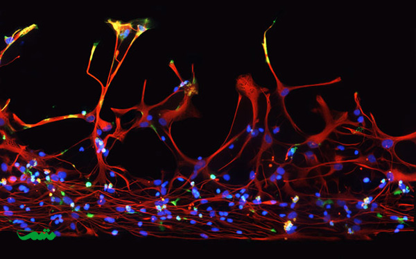 بخش تحقیقات بالینی سالت لیک سیتی، یوتا، ایالات متحده آمریکا موضوع: سلول های بنیادی عصبی انسان